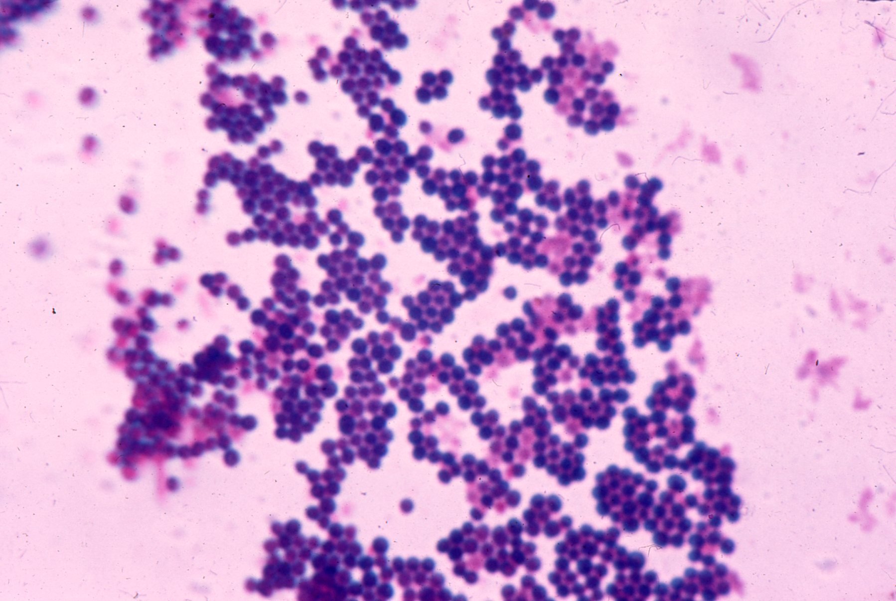 staphylococcus aureus staphylococcus aureus