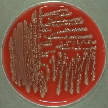 Gram-negative rods. Catalase-positive and oxidase-negative. Attacks sugars by fermentation and gas is produced. Motile. Mesophilic odour General Mesophilic Gram-negative have colonies Attacks and grey fermentation oxidase-negative 